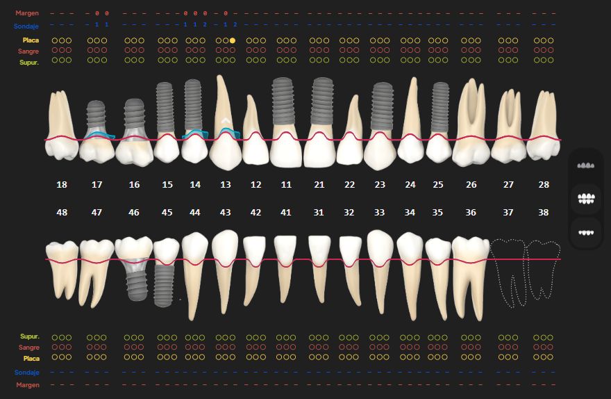 Vista periodontal
